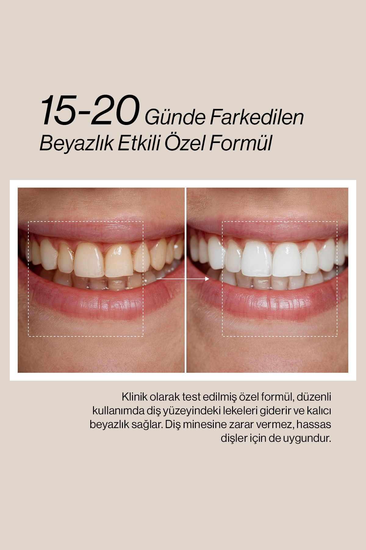 Misdent Bitkisel İçerikli & Mineralli Diş Macunu 75 ml