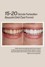 Misdent Bitkisel İçerikli & Mineralli Diş Macunu 75 ml